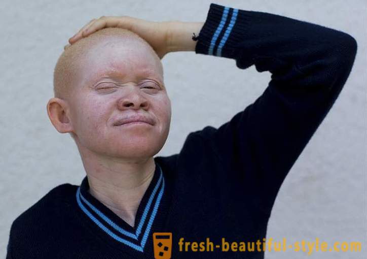 Tragična zgodovina tanzanijskih albinov