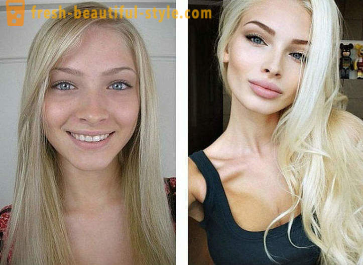 10 Ruski lepotci pred in po plastike