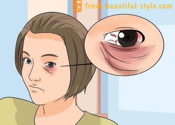 Kako masko črno oko od udarca: kozmetika, zlasti priporočila in