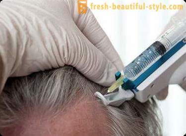Mezoterapija za lase: izdelovanje orodij in kontraindikacije