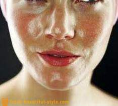 Mastna obraz kožo: kaj storiti, da se ukvarjajo s tem problemom?