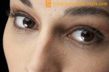 Gube pod očmi: kako odstraniti in preprečiti predčasno videz?